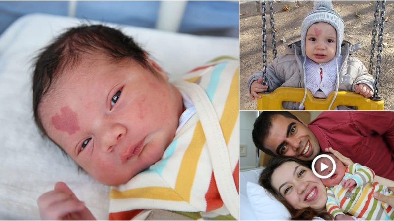 Baby born with a heart shaped birthmark