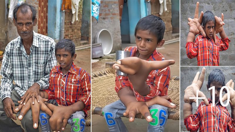 The Incredible Struggle of a Boy with Giant Hands.