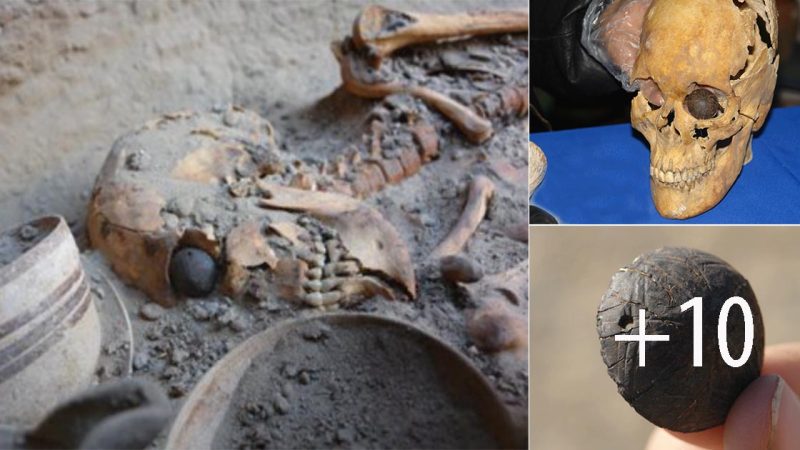 A Glimpse into the Past: The 5,000-Year-Old Prosthetic Eye of Zabol, Iran