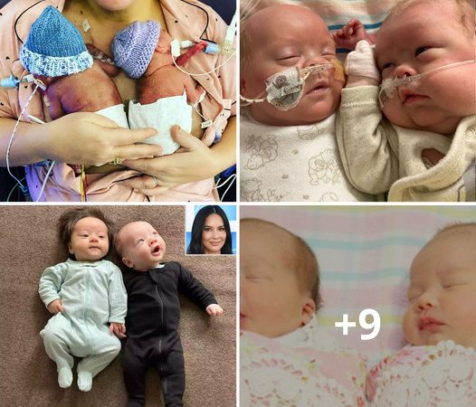 Miracle Preemies: UK Twins Born at 22 Weeks Beat the Odds and Thrive