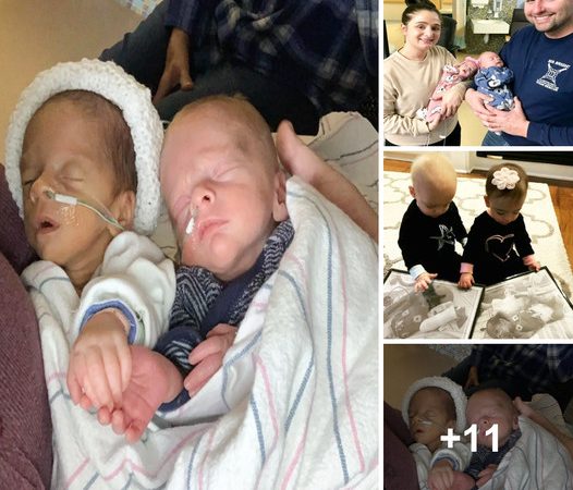 Preterm Twins Experience a Magical Moment of Resilience Holding Hands