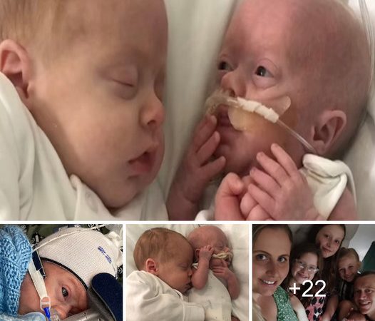 Tiny One-Pound Baby Overcomes Challenges with Twin Brother’s Cuddles