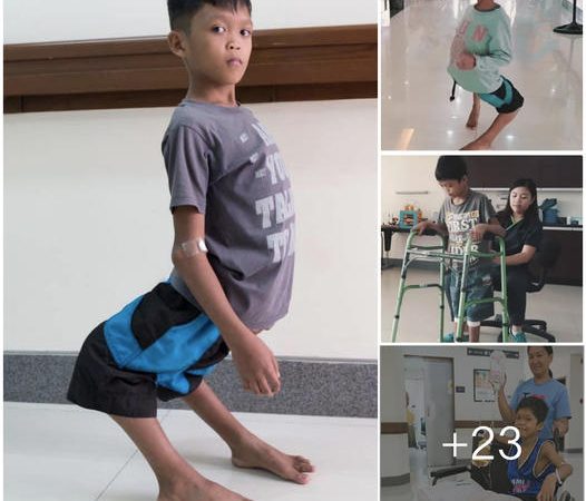 A Tale of Compassion: Transforming a Boy’s Life with ‘Flamingo’ Legs