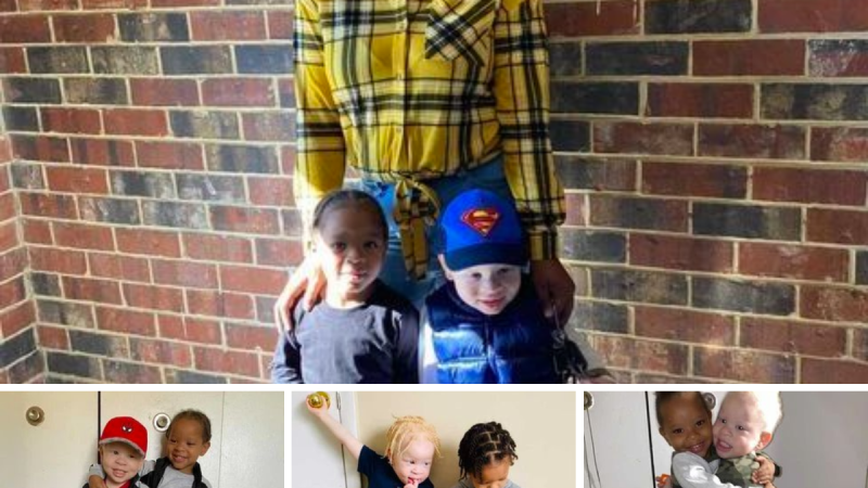 A Mother Gives Birth to Twins: One with Dark Skin and One with Albinism, Challenging Perceptions of Siblinghood