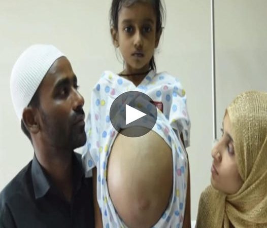 A Puzzling Enigma Unveiled: The Remarkable Journey of a 10-Year-Old Girl with a Mysterious Belly Condition